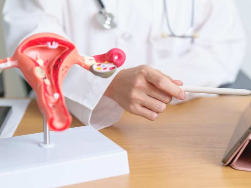 Glyph pour Protocoles de stimulation ovarienne contrôlée (SOC) : une approche personnalisée pour réussir