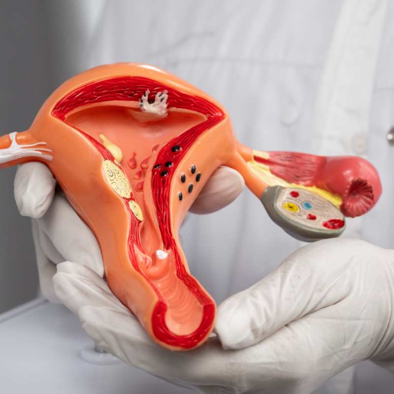 Hidrosalpinx : lo que debes saber antes de un programa de FIV