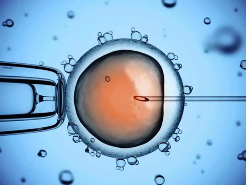 Glifo per Iniezione intracitoplasmatica dello sperma (ICSI): Una guida dettagliata