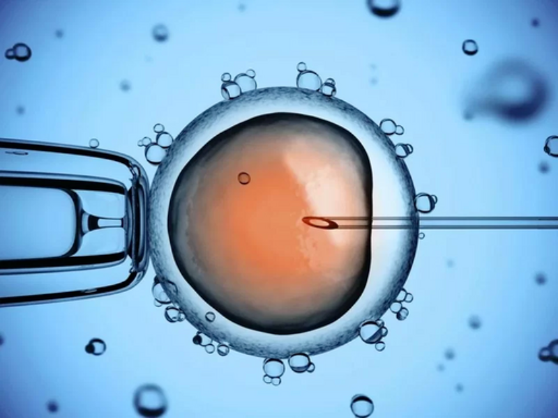 Intracytoplasmic Sperm Injection (ICSI): A Detailed Guide